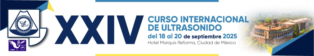 evento